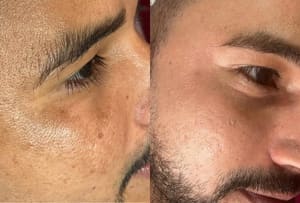 Eyeliner Tattoo result by Sirlei Beauty Spa in Brookfield, CT