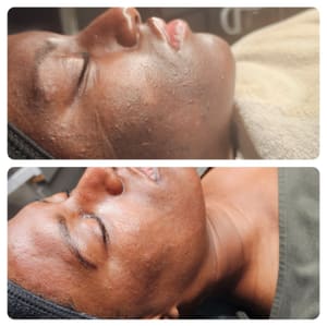 Eyeliner Tattoo result by Skin and Body Klinic Aesthetic & Wellness Center in Mt Laurel Township, NJ