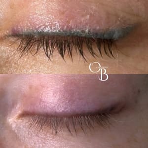 Eyeliner Tattoo result by Skinfinity Lab in Buffalo Grove, IL