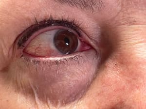 Eyeliner Tattoo result by Skintastics, LLC in Green Valley, AZ
