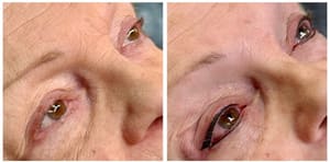 Eyeliner Tattoo result by Smart Touch Skin Solutions Nashville in Nashville Davidson Metropolitan Government, TN