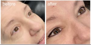 Eyeliner Tattoo result by Smart Touch Skin Solutions Nashville in Nashville Davidson Metropolitan Government, TN