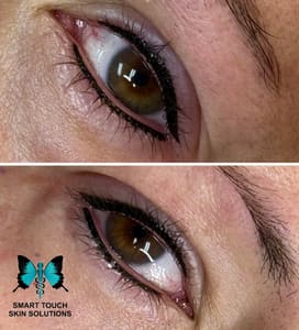 Eyeliner Tattoo result by Smart Touch Skin Solutions Nashville in Salem, IL