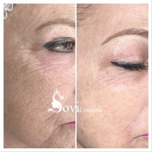 Eyeliner Tattoo result by SOVI Cosmetic in Encino, CA