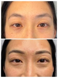 Eyeliner Tattoo result by TCBrows in Millbrae, CA