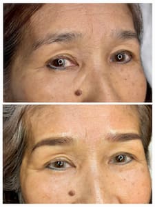 Eyeliner Tattoo result by TCBrows in Millbrae, CA