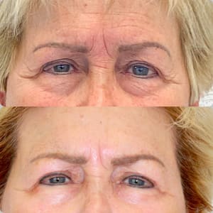 Eyeliner Tattoo result by Terri S. Mundy in Vestavia Hills, AL
