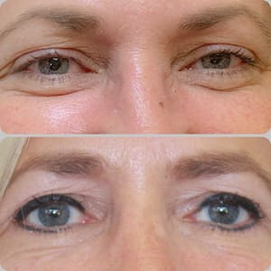 Eyeliner Tattoo result by Terri S. Mundy in Vestavia Hills, AL