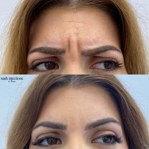 Eyeliner Tattoo result by The Aesthetics Club Nashville - By Nash Injections by Hannah in Nashville, TN