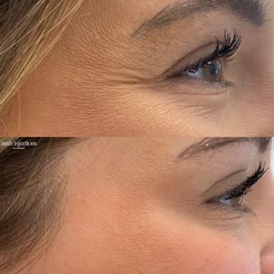 Eyeliner Tattoo result by The Aesthetics Club Nashville - By Nash Injections by Hannah in Nashville, TN