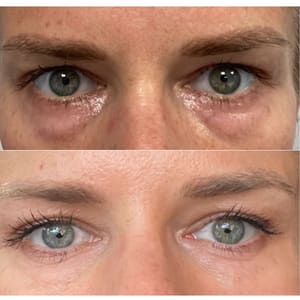 Eyeliner Tattoo result by The Vitality House - MedSpa & Wellness Clinic in Lima, OH