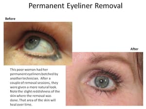 Eyeliner Tattoo result by Timeless Beauty By Renee in Plano, TX