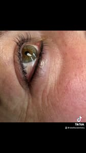 Eyeliner Tattoo result by Total Facial Artistry in Chantilly, VA
