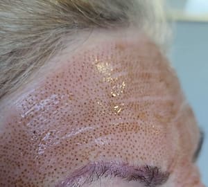 Eyeliner Tattoo result by Tulips Skin Clinic in Herndon, VA