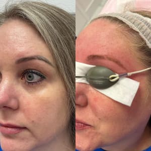 Eyeliner Tattoo result by Ultimate Brows & Lashes in Adairsville, GA