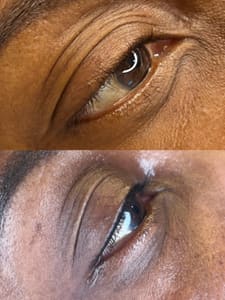 Eyeliner Tattoo result by Undertaking Beauty NYC, LLC in Middle Village, NY