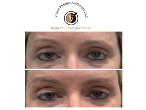 Eyeliner Tattoo result by Vickie Phillips Aesthetics LLC in Medina, OH