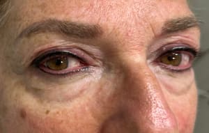 Eyeliner Tattoo result by Vivi Permanentmakeup-Brow-Microblading-Farmingdale NY in Farmingdale, NY