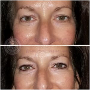 Eyeliner Tattoo result by Wanda Permanent Makeup in Naples, FL
