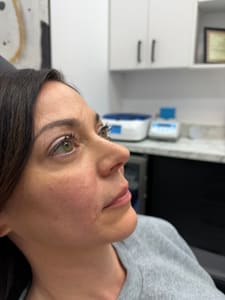 Eyeliner Tattoo result by Xquisite Med Spa, York in York, PA