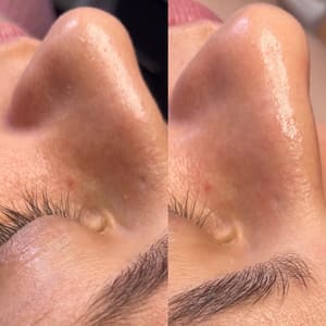 Eyeliner Tattoo result by Yuri Conde PMU & Esthetician NJ in Paramus, NJ