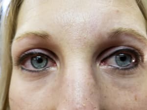 Eyeliner Tattoo result by Z Cosmetic Design, LLC in Granbury, TX