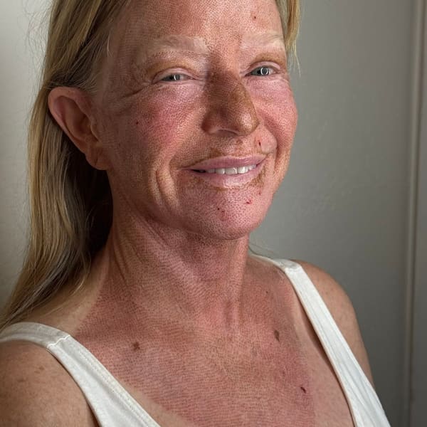 Fibroplasmabeauty - permanent makeup in Playa Del Rey, CA
