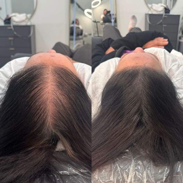 Fountain of Youth Women's Scalp Micropigmentation - permanent makeup in Berkeley, CA