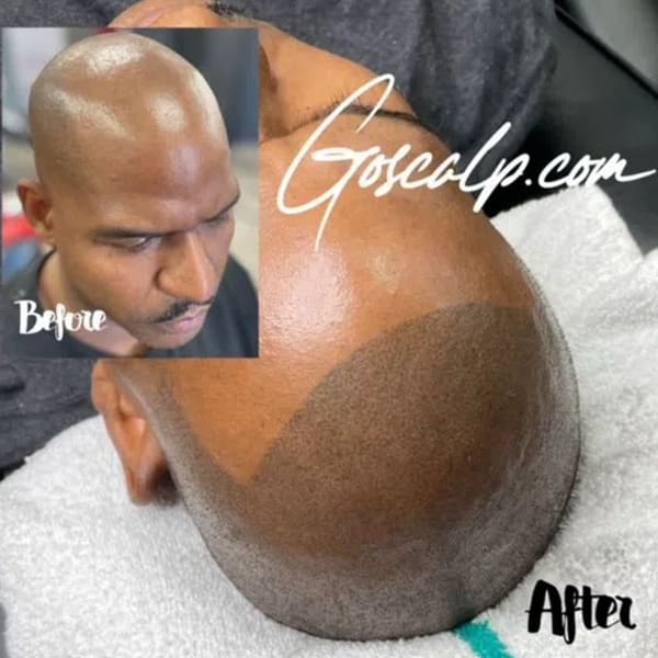 Goscalp Scalp Micropigmentation Hair Loss Center - permanent makeup in Stonecrest, GA