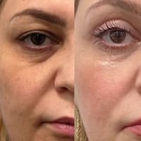 Grand Beauty and Cosmetic Spa - permanent makeup work