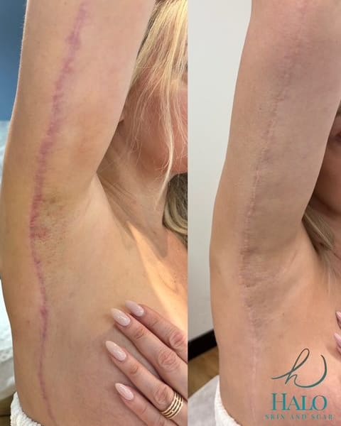 Halo Skin and Scar - permanent makeup in Irving, TX