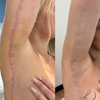Halo Skin and Scar - permanent makeup work