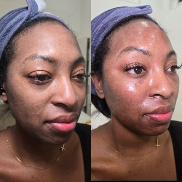 Houston MedSpa + Wellness - permanent makeup in Houston, TX