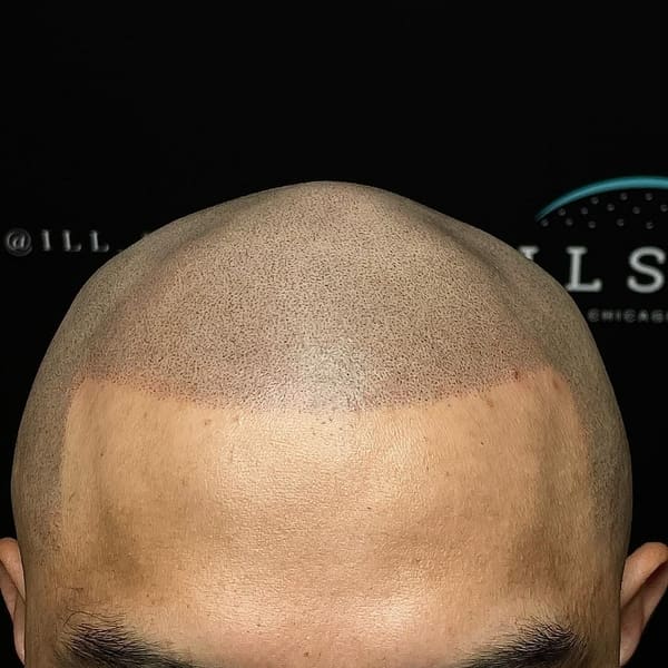 ILL SMP - permanent makeup in Chicago, IL