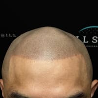 ILL SMP - permanent makeup work