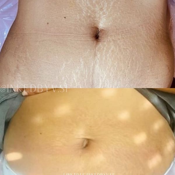 Inkling Beauty Bar - permanent makeup in San Francisco, CA