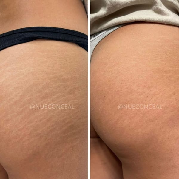 Invisible Ink Skin Solutions - permanent makeup in Walnut Creek, CA