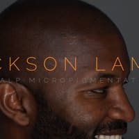 Jackson Lamar Scalp Micropigmentation - permanent makeup work