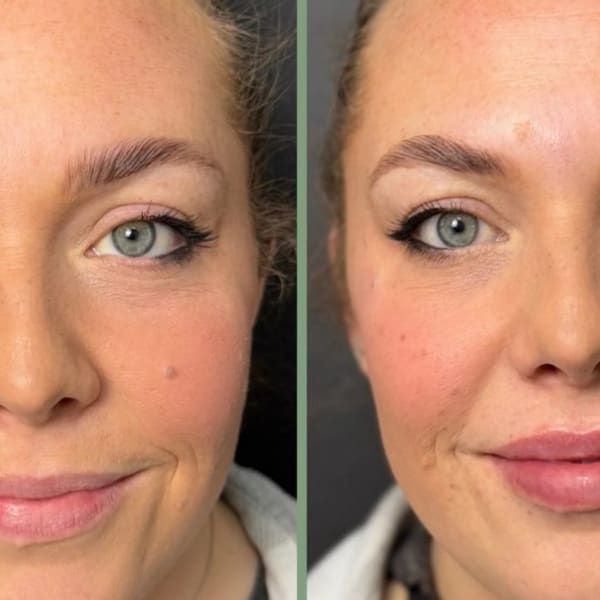 Jade MD Aesthetics Medical Spa - permanent makeup in Rancho Cucamonga, CA