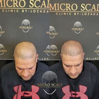 Jr Micropigmentation & Beauty Clinic - permanent makeup work