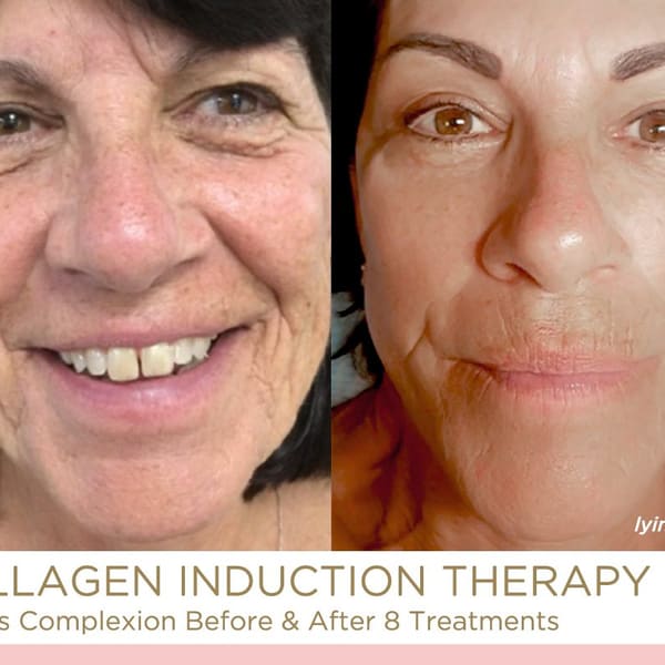 Kathryn Alexander Beautiful by Design - permanent makeup in Burbank, CA