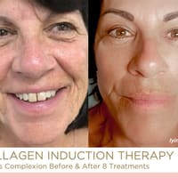 Kathryn Alexander Beautiful by Design - permanent makeup work