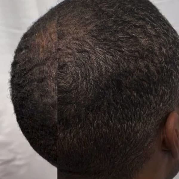 KCole Scalp Micropigmentation (SMP) - permanent makeup in Omaha, NE