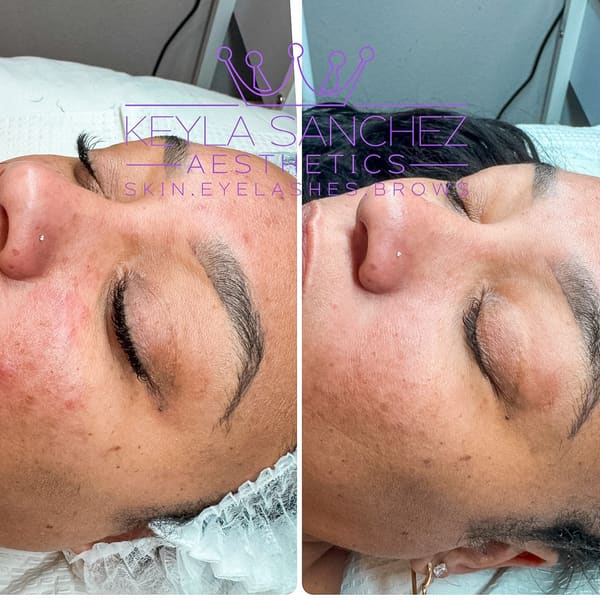 Keyla Sanchez Aesthetics - permanent makeup in Mckinney, TX