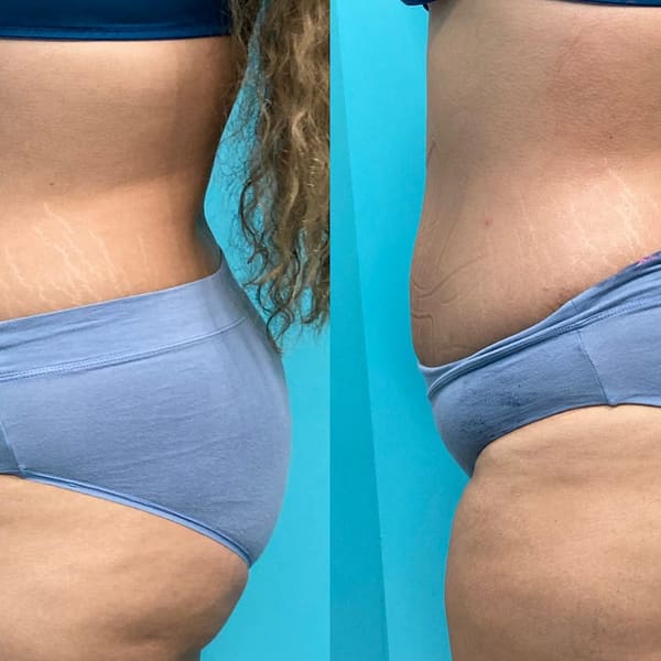 LA Body Cave - permanent makeup in Carson, CA