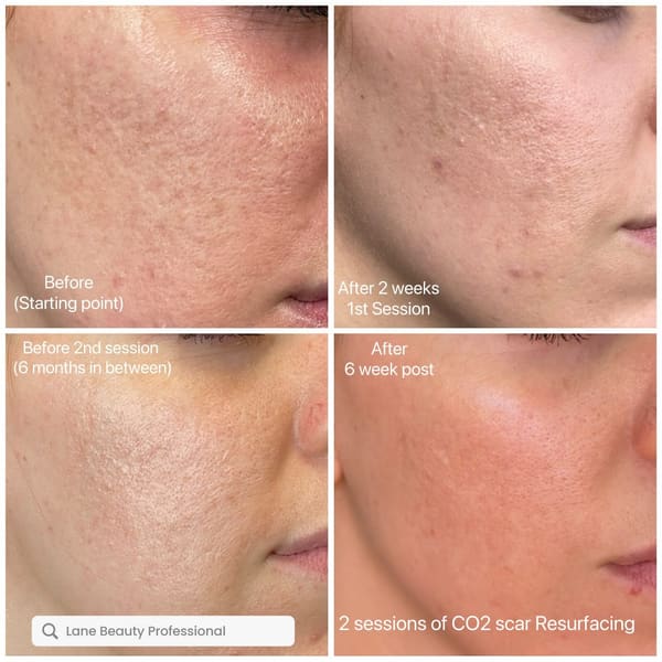Lane Beauty Professional - permanent makeup in Denver, CO