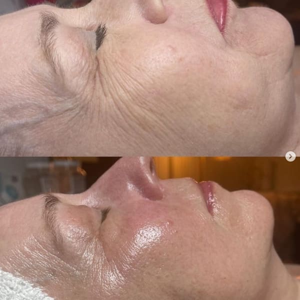 Lauren Jewel Aesthetics - permanent makeup in Jefferson, GA