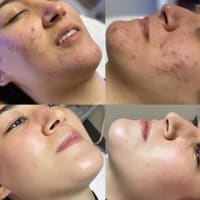 Lotus Skin Care Center - permanent makeup work