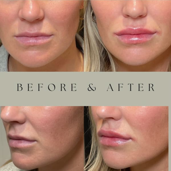 Louisville Aesthetics - permanent makeup in Hurstbourne, KY