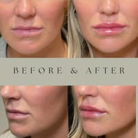 Louisville Aesthetics - permanent makeup work